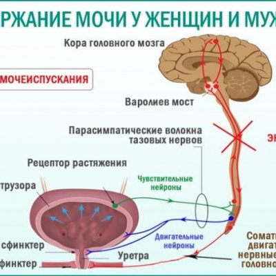 Лечение энуреза у взрослых с помощью гомеопатии