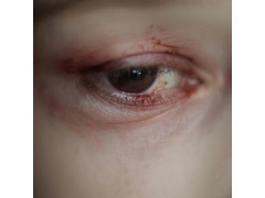 gomeopaticheskaya-pomoshch-pri-zabolevaniyah-glaz